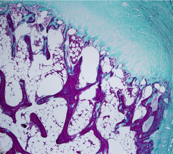 Shore - a microscope image of a hip joint showing bone in pink and cartilage in blue 
